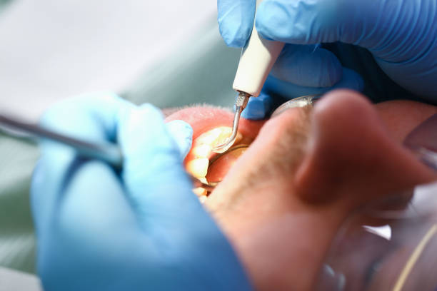 Best Emergency Tooth Extraction in Old Forge, PA