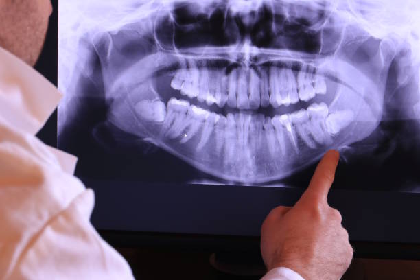 Best Same-Day Emergency Dentist in Old Forge, PA