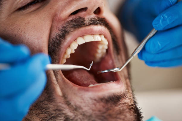 Best Emergency Broken Tooth Repair in Old Forge, PA